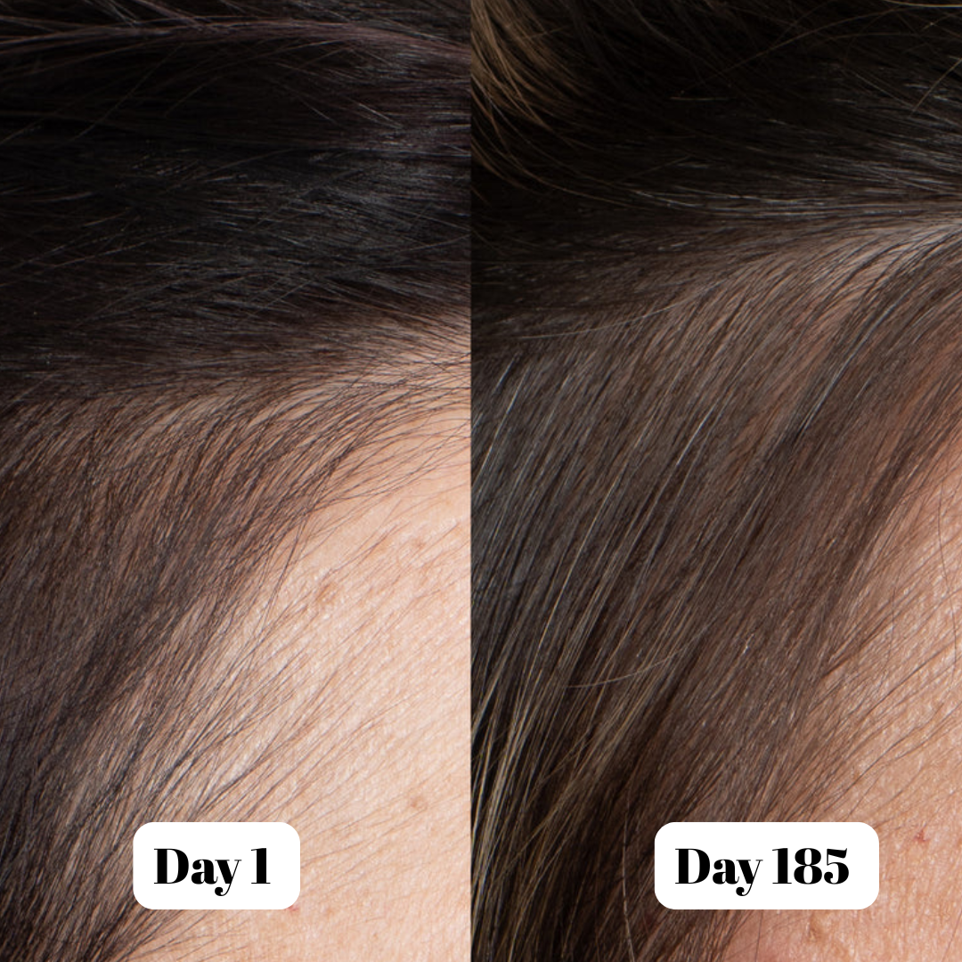 Capellí Anti Hair Fall Shampoo