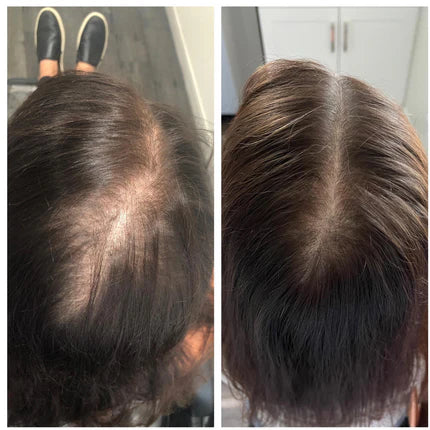 Capellí Anti Hair Fall Shampoo